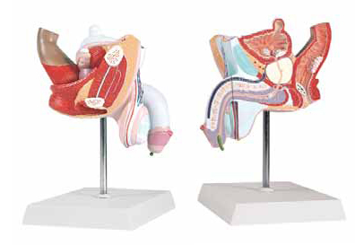 Pathological Model of the Male Urogenital System